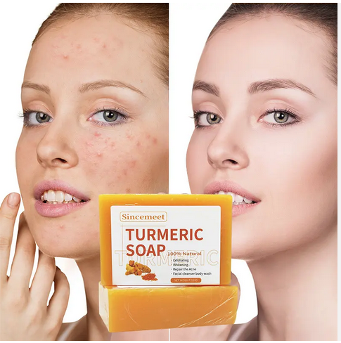 Savon Turmeric biologique pour le visage, Savon blanchissant pour la peau, Anti-acné, barre de Savon de bain Tumeric fait à la main, OEM